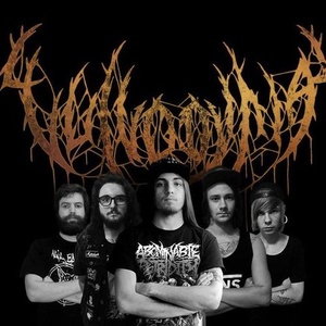 Vulvodynia